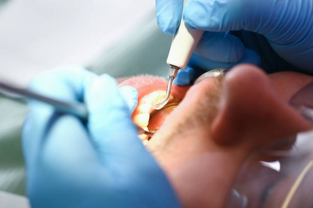 Best Emergency Denture Repair in Tuolumne City, CA